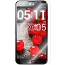 LG G Pro (F240, E980) - Folie de protecție